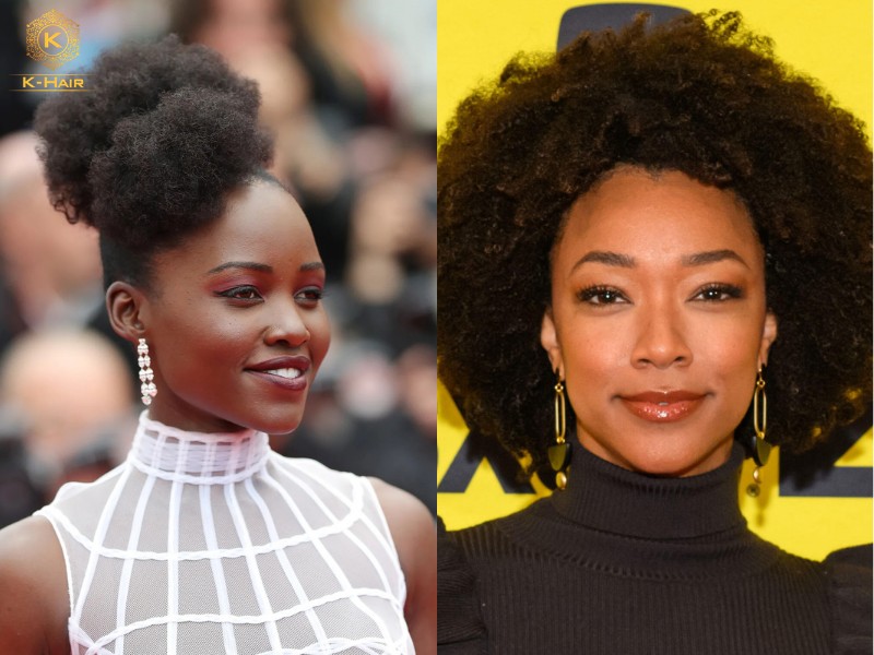 Lupita Nyong’O, Sonequa Martin-Green are some famous faces with 4C hair