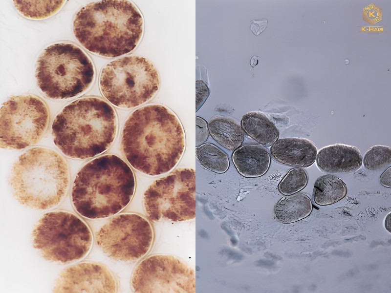 Asian Hair vs Caucasian Hair: Key Differences Explained 3 Asian hair has a perfectly round cross-section, while Caucasian hair is oval or elliptical - Microscopy of Hair - Deedrick D.W. & Koch S., 2004
